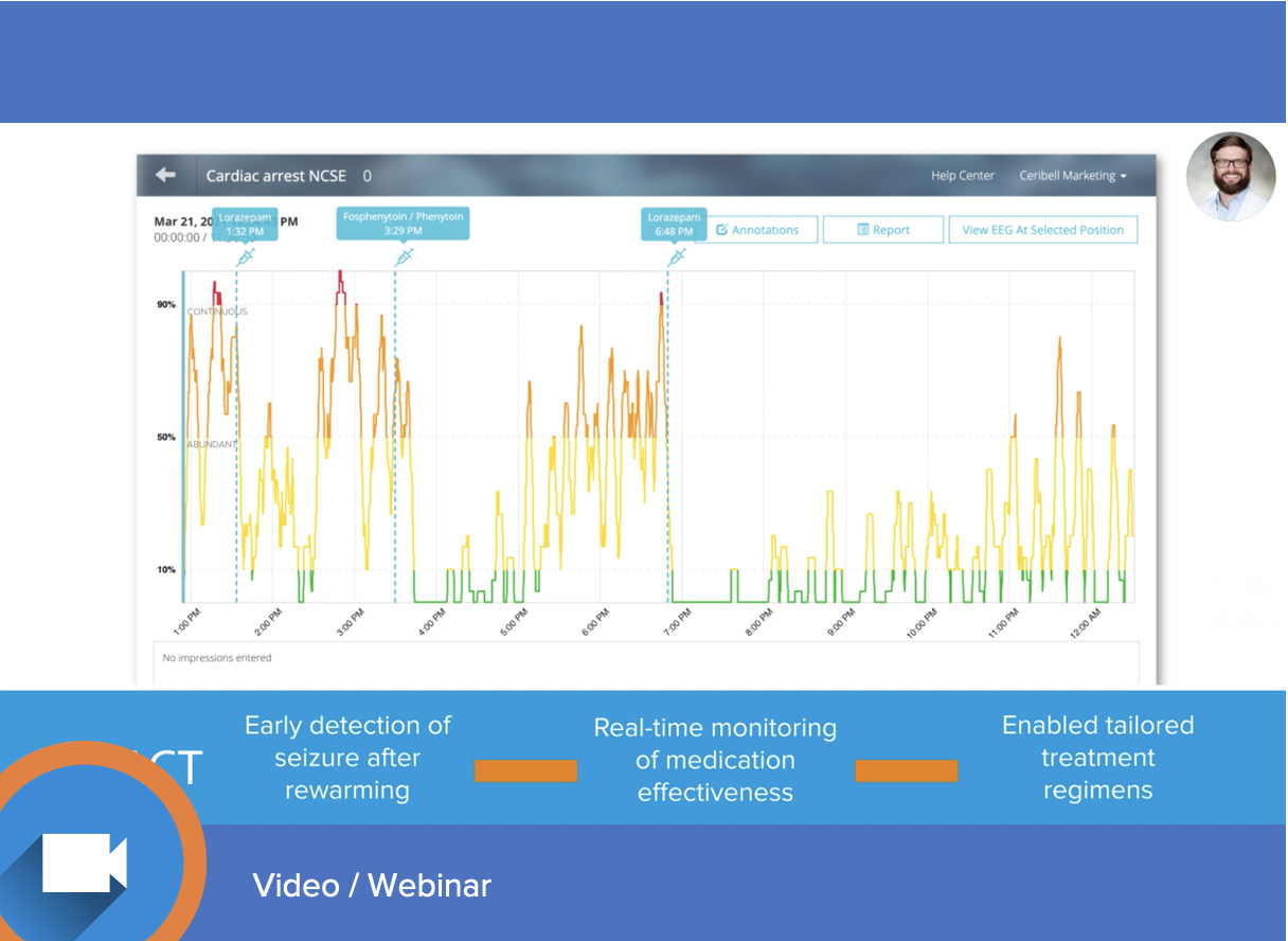 Ceribell Clarity detected NCSE in cardiac arrest patient